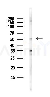 MMP3 Antibody - Western blot analysis of lysates from HepG2 cells(starvation,24h treatment), using MMP3 Antibody at 1/1000 dilution.