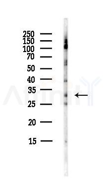 MMP7 Antibody - Western blot analysis of lysates from HepG2 cells(starvation,24h treatment), using MMP7 Antibody at 1/1000 dilution.