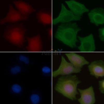 NM23 Antibody - AF0222 staining Hela cells by IF/ICC.