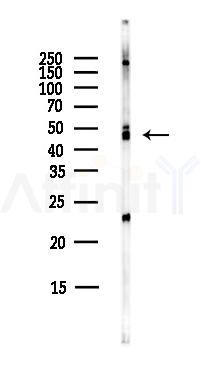 NSE Antibody - Western blot analysis of lysates from HepG2 cells(LPS,4h treatment), using NSE Antibody at 1/1000 dilution.