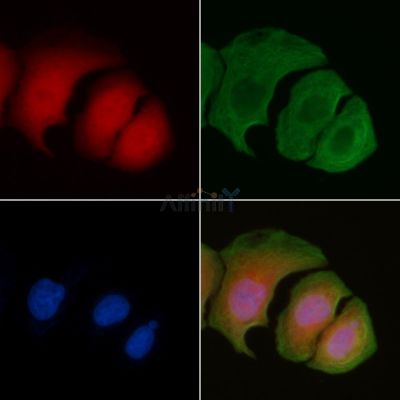 CDKN2A/p16INK4a Antibody - AF0228 staining Hela cells by IF/ICC.