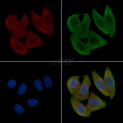p15 INK4b Antibody - AF0230 staining Hela cells(30min of UV treatment) by IF/ICC.