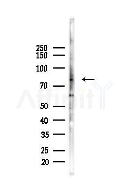 p63 Antibody - Western blot analysis of lysates from HepG2 cells(starvation,24h treatment), using p63 Antibody at 1/1000 dilution.