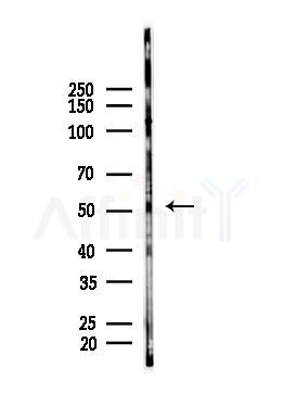 Parkin Antibody - Western blot analysis of lysates from PC12 cells, using Parkin Antibody at 1/1000 dilution.