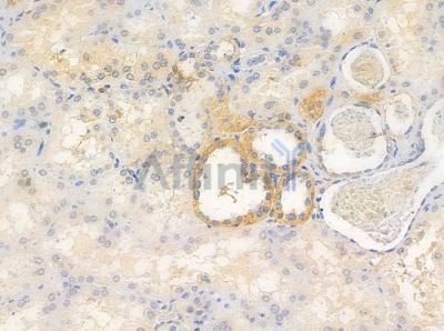 Patched/PTCH1 Antibody - AF0237 at 1/100 staining human normal kidney tissue by IHC-P.
