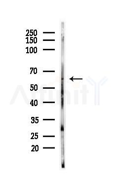 Presenilin 1 Antibody - Western blot analysis of lysates from Mouse testis, using Presenilin 1 Antibody at 1/1000 dilution.