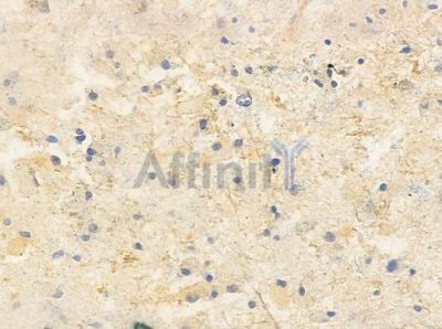 Presenilin 1 Antibody - AF0245 at 1/100 staining human astrocytoma by IHC-P.