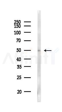 Retinoic Acid Receptor beta Antibody - Western blot analysis of lysates from Mouse lung, using Retinoic Acid Receptor beta Antibody at 1/1000 dilution.