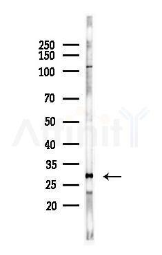 SNAP25 Antibody - Western blot analysis of lysates from PC12 cells, using SNAP25 Antibody at 1/1000 dilution.