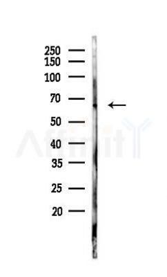 TGFBR2 Antibody - Western blot analysis of lysates from 293 cells, using TGFBR2 Antibody at 1/1000 dilution.