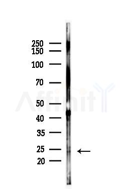TIMP2 Antibody - Western blot analysis of lysates from HepG2 cells(starvation,24h treatment), using TIMP2 Antibody at 1/1000 dilution.