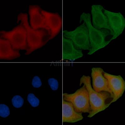 TIMP3 Antibody - AF0265 staining Hela cells(45min of heat-shock) by IF/ICC.
