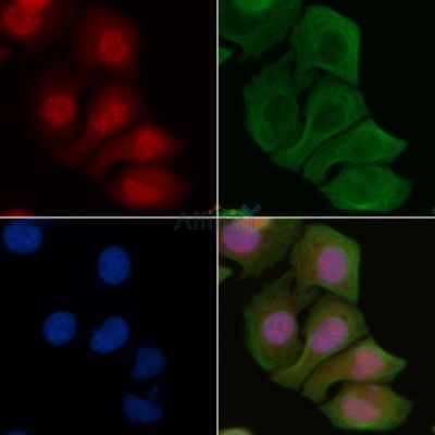 CDK7 Antibody - AF0267 staining Hela cells by IF/ICC.
