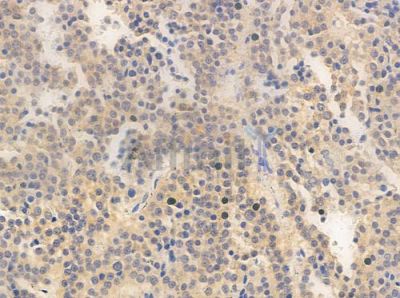 NYREN18 Antibody - AF0272 at 1/100 staining human pituitary adenoma by IHC-P.