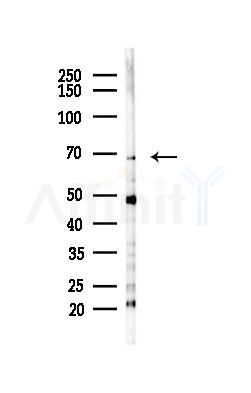 PIAS2 Antibody - Western blot analysis of lysates from HepG2 cells(starvation,24h treatment), using PIAS2 Antibody at 1/1000 dilution.