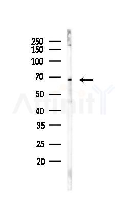 PIAS2 Antibody - Western blot analysis of lysates from 293 cells, using PIAS2 Antibody at 1/1000 dilution.