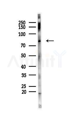 SENP1 Antibody - Western blot analysis of lysates from PC12 cells, using SENP1 Antibody at 1/1000 dilution.