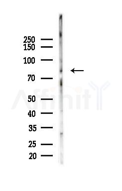 SENP1 Antibody - Western blot analysis of lysates from HepG2 cells(starvation,24h treatment), using SENP1 Antibody at 1/1000 dilution.