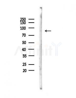 SENP5 Antibody - Western blot analysis of lysates from HepG2 cells(heat-shock,45min treatment), using SENP5 Antibody at 1/1000 dilution.