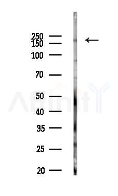 TOP2B Antibody - Western blot analysis of lysates from COLO205 cells(heat-shock,45min treatment), using TOP2B Antibody at 1/1000 dilution.