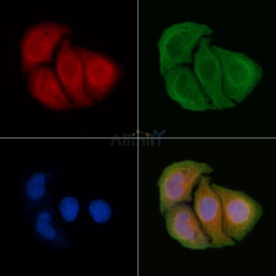 TRADD Antibody - AF0284 staining Hela cells by IF/ICC.
