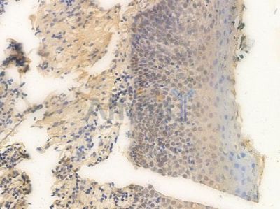 TRADD Antibody - AF0284 at 1/100 staining human normal tonsil tissue by IHC-P.