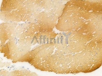 Tubulin gamma Antibody - AF0285 at 1/100 staining human normal gastric tissue by IHC-P.