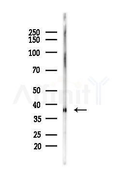 XRCC3 Antibody - Western blot analysis of lysates from HepG2 cells(starvation,24h treatment), using XRCC3 Antibody at 1/1000 dilution.