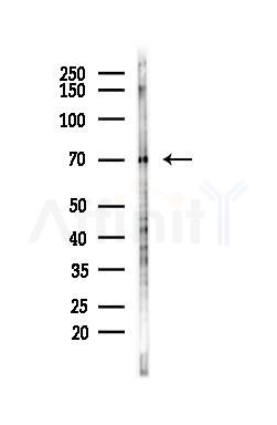 Ku70 Antibody - Western blot analysis of lysates from HepG2 cells(starvation,24h treatment), using Ku70 Antibody at 1/1000 dilution.