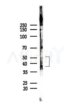 DR4 Antibody - Western blot analysis of lysates from PC12 cells, using DR4 Antibody at 1/1000 dilution.