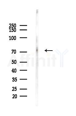 AKAP10 Antibody - Western blot analysis of lysates from HepG2 cells(heat-shock,45min treatment), using AKAP10 Antibody at 1/1000 dilution.