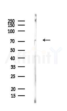 AKAP10 Antibody - Western blot analysis of lysates from PC12 cells, using AKAP10 Antibody at 1/1000 dilution.