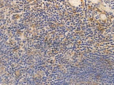 DLX3 Antibody - AF0339 at 1/100 staining human normal tonsil tissue by IHC-P.