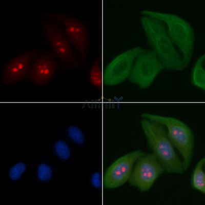MED24 Antibody - AF0346 staining Hela cells by IF/ICC.