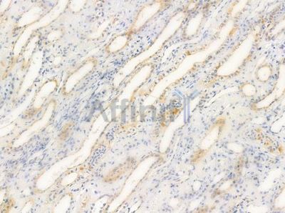 CIB2 Antibody - AF0349 at 1/100 staining human normal kidney tissue by IHC-P.