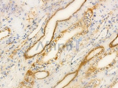 NDUC2 Antibody - AF0351 at 1/100 staining human normal kidney tissue by IHC-P.