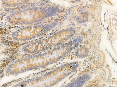NDUC2 Antibody - AF0351 at 1/100 staining human normal colon tissue by IHC-P.