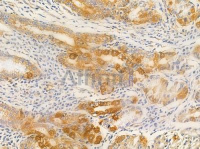 NDUC2 Antibody - AF0351 at 1/100 staining human normal gastric tissue by IHC-P.