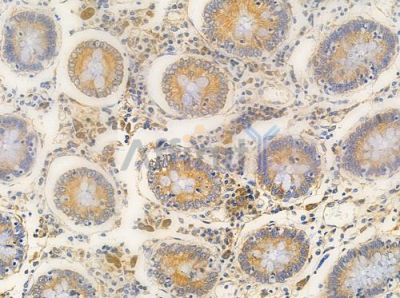 NDUC2 Antibody - AF0351 at 1/100 staining human normal colon tissue by IHC-P.