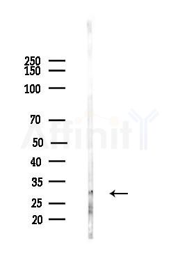 PTTG1 Antibody - Western blot analysis of lysates from HepG2 cells(heat-shock,45min treatment), using PTTG1 Antibody at 1/1000 dilution.