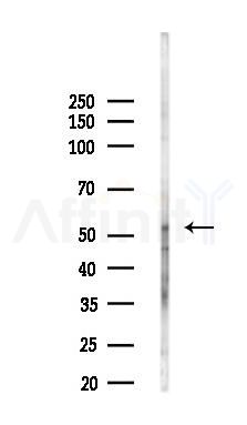 MUTYH Antibody - Western blot analysis of lysates from COLO205 cells(heat-shock,45min treatment), using MUTYH Antibody at 1/1000 dilution.