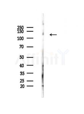 ADNP Antibody - Western blot analysis of lysates from Mouse liver, using ADNP Antibody at 1/1000 dilution.