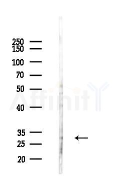 TNFRSF6B Antibody - Western blot analysis of lysates from HepG2 cells(heat-shock,45min treatment), using TNFRSF6B Antibody at 1/1000 dilution.