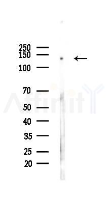 EGFR Antibody - Western blot analysis of lysates from HepG2 cells(heat-shock,45min treatment), using EGFR Antibody at 1/1000 dilution.