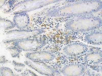 MED17 Antibody - AF0440 at 1/100 staining human normal colon tissue by IHC-P.