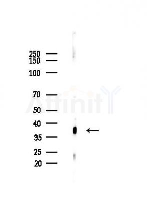 Nucleophosmin Antibody - Western blot analysis of lysates from HepG2 cells(heat-shock,45min treatment), using Nucleophosmin Antibody at 1/1000 dilution.