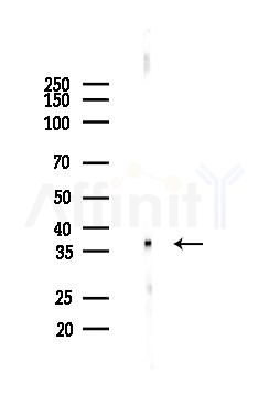 Nucleophosmin Antibody - Western blot analysis of lysates from Mouse liver, using Nucleophosmin Antibody at 1/1000 dilution.