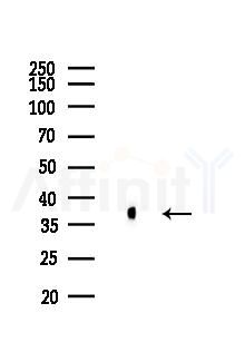 Nucleophosmin Antibody - Western blot analysis of lysates from B16F10-LUC cells, using Nucleophosmin Antibody at 1/1000 dilution.