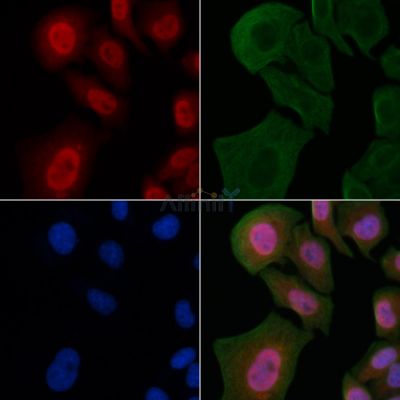 MN1 Antibody - AF0469 staining Hela cells by IF/ICC.