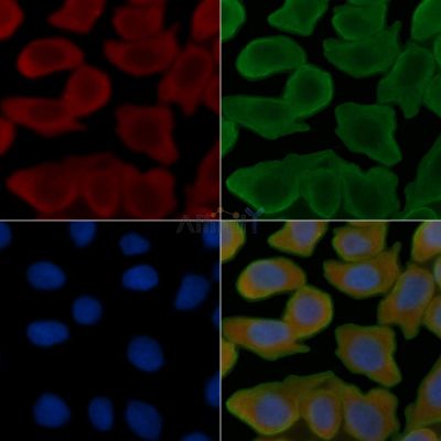 ECRG4 Antibody - AF0475 staining Hela cells(30min of UV treatment) by IF/ICC.